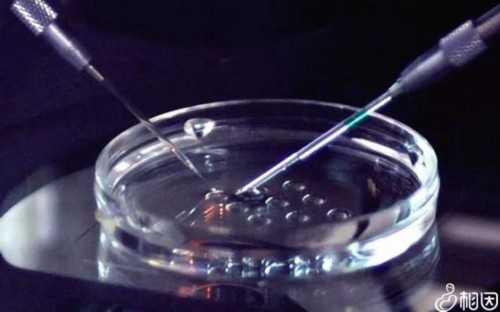 试管婴儿成功率高医院选择与个人经历分享