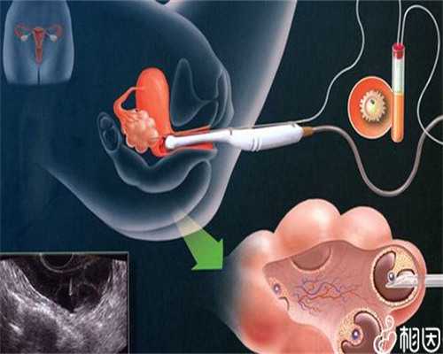 试管婴儿费用解析与助孕医院选择指南