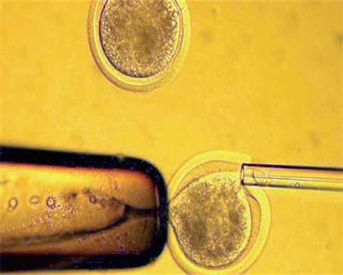 大连地区供卵试管婴儿医院选择与三代技术解析