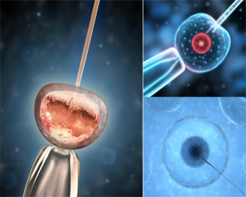 试管婴儿医院排名与费用解析，助孕选择指南