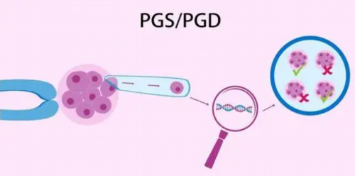 大连妇幼保健院是否支持三代试管婴儿技术？