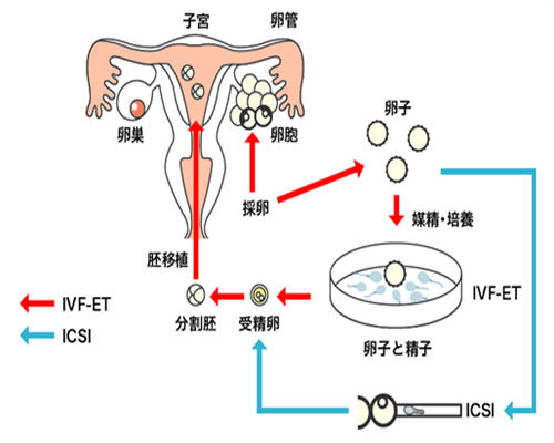 大连首例三冻试管婴儿成功诞生，辅助生殖技术取得新突破