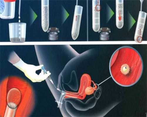 三代试管婴儿医院排名及成功率解析
