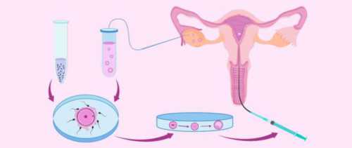 大连供卵服务选择指南：排队时间解析与费用详情