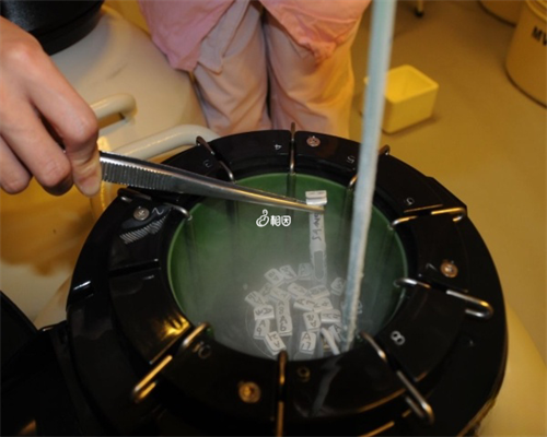 剖腹产后多久能恢复性生活